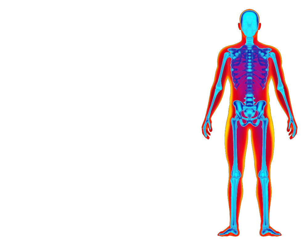 DXA body composition scan image showing muscle, fat and bone tissue