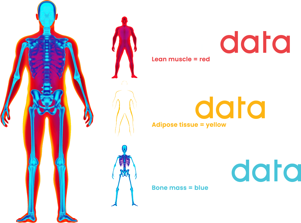 DXA scans are more precise than other body composition tests Body composition scan results showing lean muscle, adipose tissue and bone mass
