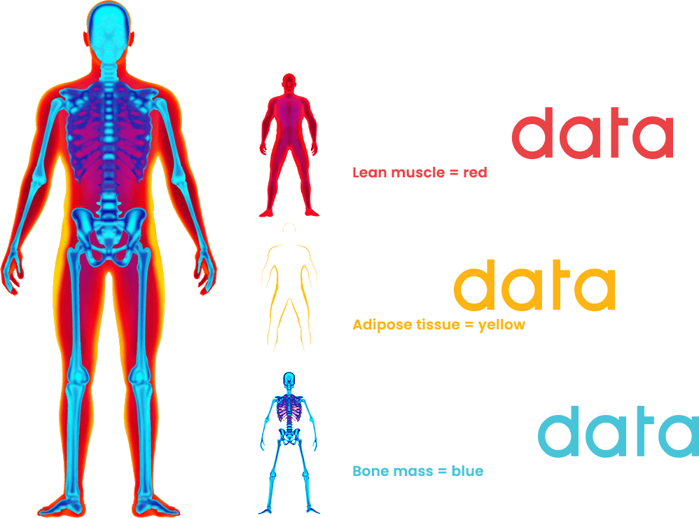 DXA scans show you the precise location of bone mass, lean muscle, and fat in the body