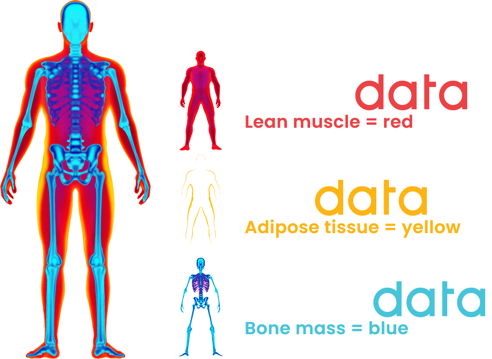 DXA scans show you the precise location of bone mass, lean muscle, and fat in the body